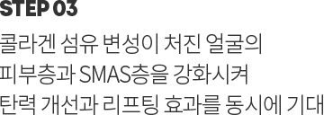 step 03