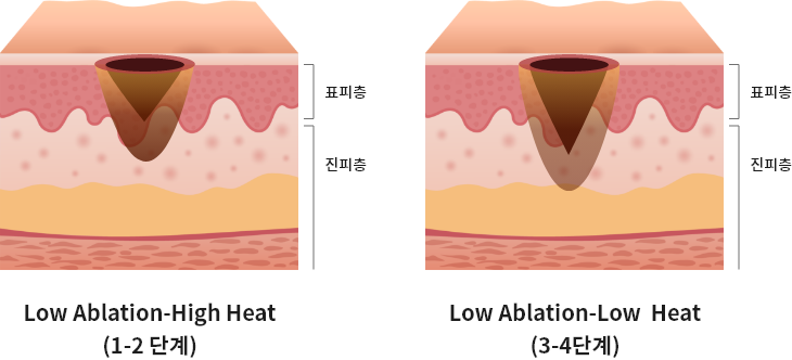 엘라비에 리투오
